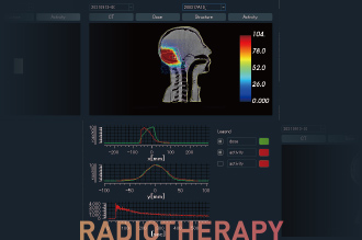 RADIOTHERAPY